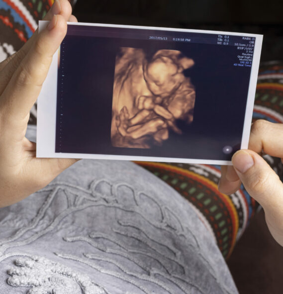 A young mother holding an unborn baby sonography 4D image and resting on a sofa